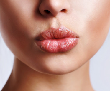 schöne Lippen nach einer Lippenvergrößerung